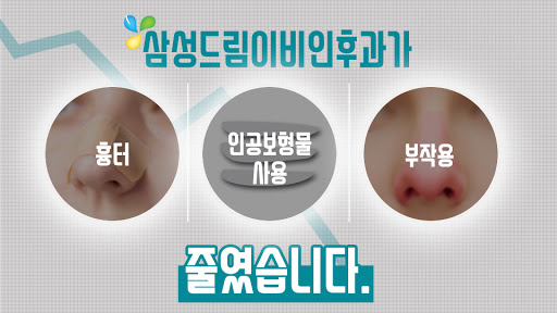 휜코성형 잘하는곳