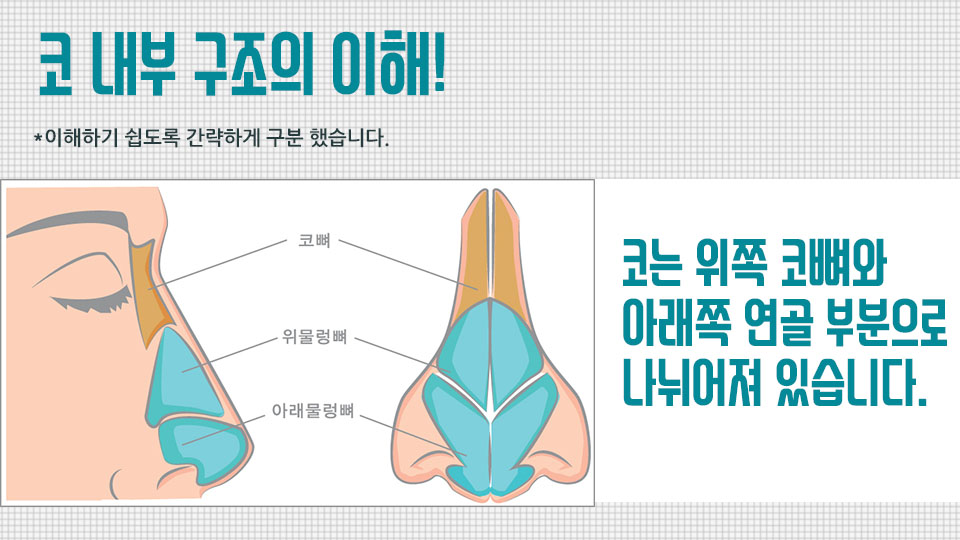 매부리코교정비용