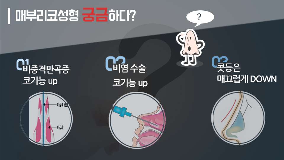 여자 매부리코