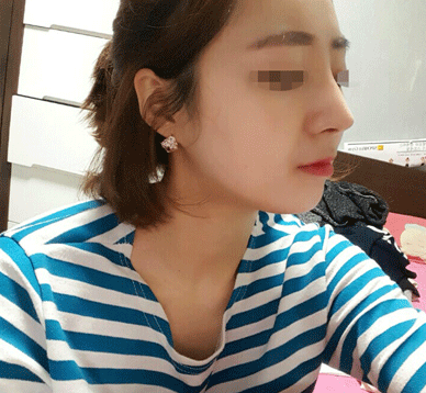 리얼셀카후기